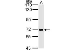 WB Image Sample (30 ug of whole cell lysate) A: H1299 7. (SLC20A1 Antikörper)