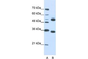 WB Suggested Anti-WDR6 Antibody Titration:  0. (WDR6 Antikörper  (C-Term))