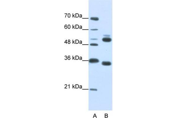 WDR6 Antikörper  (C-Term)