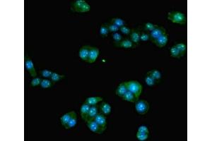 Immunofluorescent analysis of PC-3 cells using ABIN7155729 at dilution of 1:100 and Alexa Fluor 488-congugated AffiniPure Goat Anti-Rabbit IgG(H+L) (HOXA9 Antikörper  (AA 1-190))