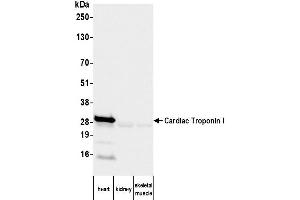 Western Blotting (WB) image for anti-Cardiac Troponin I (TNNI3) antibody (ABIN7795611) (TNNI3 Antikörper)