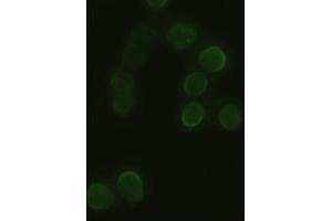 Anti-HHex mouse monoclonal antibody (ABIN2452343) immunofluorescent staining of HeLa cells transiently transfected by pCMV6-ENTRY HHex (RC204815) (HHEX Antikörper  (AA 100-270))