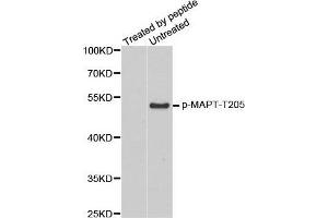 Western Blotting (WB) image for anti-Microtubule-Associated Protein tau (MAPT) (pThr205) antibody (ABIN3019698) (MAPT Antikörper  (pThr205))