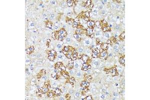 Immunohistochemistry (IHC) image for anti-Wingless-Type MMTV Integration Site Family, Member 1 (WNT1) (AA 231-370) antibody (ABIN1683291)