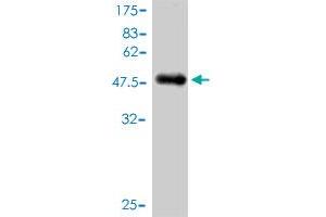 Western Blot detection against Immunogen (44. (NUDT3 Antikörper  (AA 1-172))