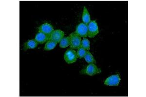 IF analysis of Hsp70 using anti-Hsp70 antibody (ABIN5693238).