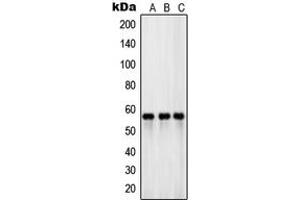 Western blot analysis of EAAT3 expression in PANC1 (A), HeLa (B), human testis (C) whole cell lysates.