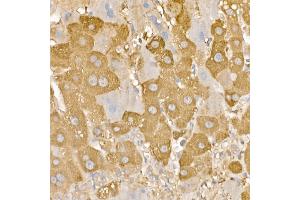 Immunohistochemistry of paraffin-embedded human liver using [KO Validated] RA Rabbit pAb (ABIN3021646, ABIN3021647, ABIN3021648 and ABIN1513457) at dilution of 1:100 (40x lens). (RAB5 Antikörper  (AA 1-215))