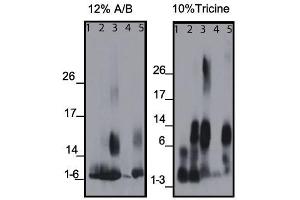 Western blots of the monoclonal antibody binding to different amyloid beta (Abeta) regions of human and mouse protein, using 12% A/B (acrylamide/bisacrylamide) or 10% Tricine matrix.