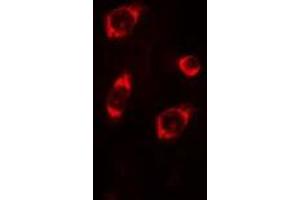 ABIN6275244 staining COLO205 cells by IF/ICC.