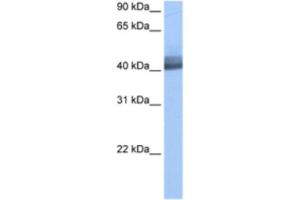 Western Blotting (WB) image for anti-RNA Binding Motif Protein 4 (RBM4) antibody (ABIN2462133) (RBM4 Antikörper)