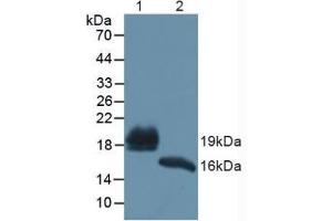 Figure. (REG1B Antikörper  (AA 23-166))