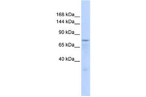WB Suggested Anti-ZFP62 Antibody Titration:  0.