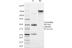 SDS-PAGE Analysis Purified Cytokeratin 16 Mouse Monoclonal Antibody (LL025). (KRT16 Antikörper  (C-Term))