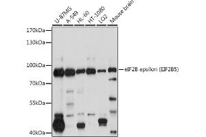 Western blot analysis of extracts of various cell lines, using eIF2B epsilon (eIF2B epsilon (EIF2B5)) antibody (ABIN6130359, ABIN6140041, ABIN6140042 and ABIN6214448) at 1:1000 dilution. (EIF2B5 Antikörper  (AA 442-721))