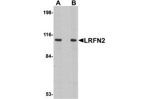 Western Blotting (WB) image for anti-Leucine Rich Repeat and Fibronectin Type III Domain Containing 2 (LRFN2) (C-Term) antibody (ABIN1030490)