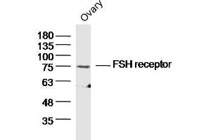 Mouse ovary lysates probed with FSH Receptor Polyclonal Antibody  at 1:300 overnight at 4°C followed by a conjugated secondary antibody for 60 minutes at 37°C. (FSHR Antikörper  (AA 21-100))