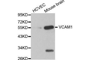 Western blot analysis of extracts of various cell lines, using VCAM1 antibody.