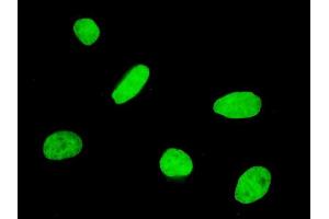 Immunofluorescence of monoclonal antibody to FOXQ1 on HeLa cell. (FOXQ1 Antikörper  (AA 110-219))