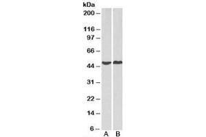 Western blot testing of human A) HeLa and B) MCF7 cell lysate with PRKACA antibody at 2ug/ml. (PRKACA Antikörper)
