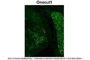 Immunohistochemistry (IHC) image for anti-One Cut Homeobox 1 (ONECUT1) (C-Term) antibody (ABIN2777516)