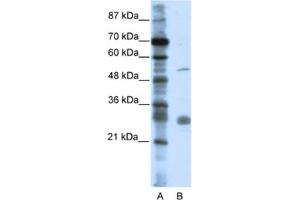 Western Blotting (WB) image for anti-Leucine Rich Repeat Containing 14 (LRRC14) antibody (ABIN2461029)