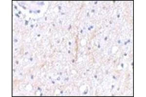 Immunohistochemical staining of human brain tissue using AP30681PU-N at 2. (PLXDC2 Antikörper  (C-Term))