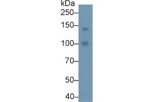 Detection of PLCb4 in Human A549 cell lysate using Polyclonal Antibody to Phospholipase C Beta 4 (PLCb4) (Phospholipase C beta 4 Antikörper  (AA 2-250))