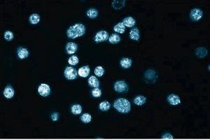 Immunofluorescence staining of HL-60 cells (Human promyelocytic leukemia, ATCC CCL-240). (Plakophilin 2 Antikörper  (AA 19-183))