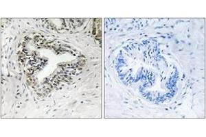 Immunohistochemistry analysis of paraffin-embedded human prostate carcinoma tissue, using RPL30 Antibody.