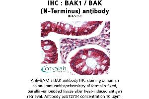 Image no. 1 for anti-BCL2-Antagonist/killer 1 (BAK1) (N-Term) antibody (ABIN1732215) (BAK1 Antikörper  (N-Term))