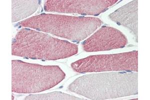 Image no. 1 for anti-Cytochrome P450, Family 2, Subfamily D, Polypeptide 6 (CYP2D6) (AA 268-457) antibody (ABIN467616) (CYP2D6 Antikörper  (AA 268-457))