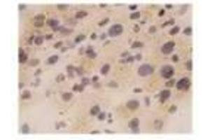 Image no. 2 for anti-Tumor Necrosis Factor alpha (TNF alpha) antibody (ABIN791557) (TNF alpha Antikörper)
