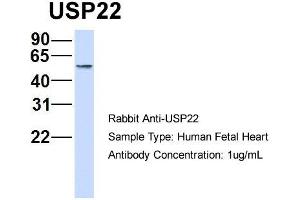 Host: Rabbit   Target Name: USP22   Sample Tissue: Human Fetal Heart  Antibody Dilution: 1. (USP22 Antikörper  (Middle Region))