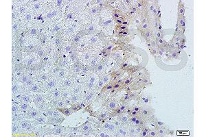 Formalin-fixed and paraffin-embedded mouse liver tissue labeled with Rabbit Anti-TNFSF14 Polyclonal Antibody, Unconjugated (ABIN740625) 1:200 followed by conjugation to the secondary antibody and DAB staining (TNFSF14 Antikörper  (AA 141-240))