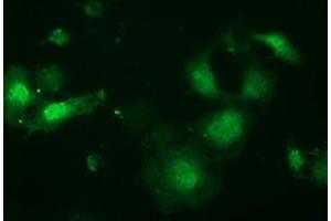 Anti-LIN7B mouse monoclonal antibody (ABIN2453853) immunofluorescent staining of COS7 cells transiently transfected by pCMV6-ENTRY LIN7B (RC205598). (LIN7B Antikörper)