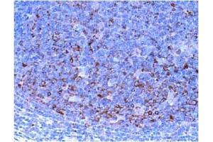 Immunohistochemistry (IHC) image for anti-Checkpoint Kinase 1 (CHEK1) antibody (ABIN487487) (CHEK1 Antikörper)