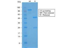 SDS-PAGE analysis of purified, BSA-free recombinant NKX2. (NKX2-1 Antikörper)