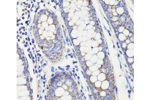 Immunohistochemistry of paraffin-embedded Human colon using PDCD10 Polyclonal Antibody at dilution of 1:100 (40x lens).