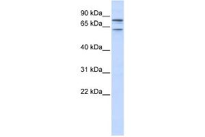 WB Suggested Anti-KCNQ1 Antibody Titration:  0. (KCNQ1 Antikörper  (N-Term))