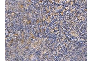 ABIN6263001 and ABIN6266814 at 1/100 staining human normal tonsil tissue by IHC-P.