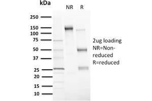SDS-PAGE Analysis Purified MDM2 Mouse Monoclonal Antibody (MDM2/2414). (MDM2 Antikörper  (AA 126-254))