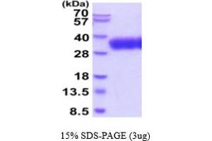 SDS-PAGE (SDS) image for SLAM Family Member 6 (SLAMF6) (AA 22-226) protein (His tag) (ABIN5854757) (SLAMF6 Protein (AA 22-226) (His tag))