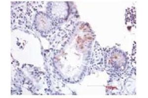 Immunohistochemistry (IHC) image for anti-Defensin beta 2 (BD-2) (AA 4-41) antibody (ABIN191996) (beta 2 Defensin Antikörper  (AA 4-41))