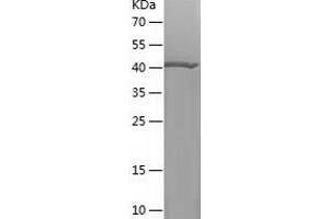 G3BP1 Protein (AA 278-466) (His-IF2DI Tag)