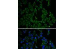 Immunofluorescence analysis of HeLa cells using NF2 Polyclonal Antibody (Merlin Antikörper)