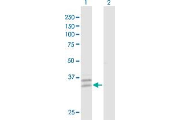 PPT2 Antikörper  (AA 1-302)