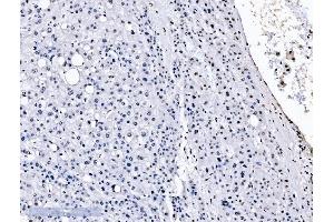 IHC analysis of splicing factor 1 using anti-splicing factor 1 antibody (ABIN7600193).