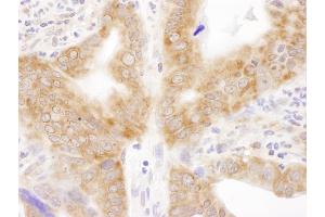 anti-Ribosomal Protein L6 (RPL6) (AA 25-75) antibody