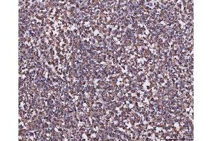 IHC analysis of MTHFD1 using anti-MTHFD1 antibody (ABIN7600631).